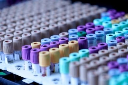 lab samples